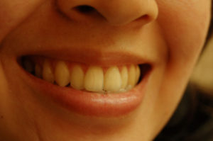teeth-1435698